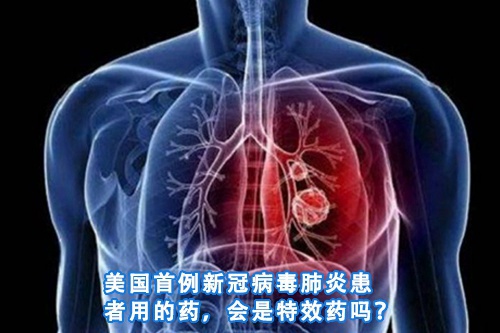 招标问答(86)|如何处理单一来源采购公示的异议?